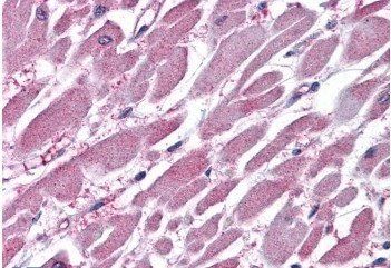 PP2A/PPP2R1A Antibody