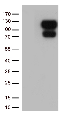 PPP2R1B Antibody