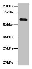 PPP2R1B Antibody
