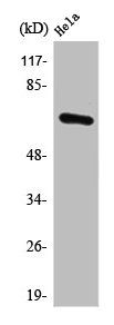 PPP2R1B Antibody