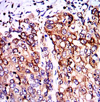 PPP2R4 Antibody