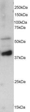 PPP2R5E Antibody