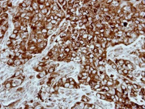 PPP3CB Rabbit Polyclonal Antibody