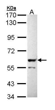 PPP3CB Rabbit Polyclonal Antibody