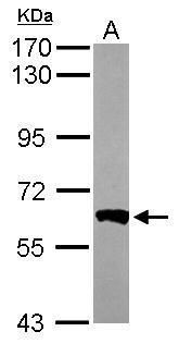 PPP3CB Rabbit Polyclonal Antibody