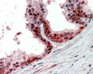 PPP4C Antibody