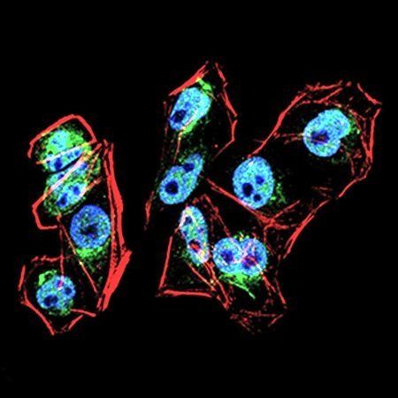 PRDM1 Antibody