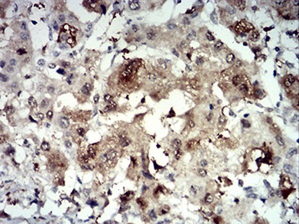 PRDM4 Antibody