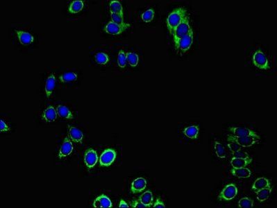 PRDX3 Antibody
