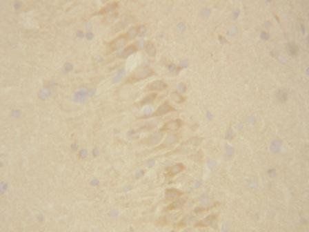 Presenilin 2/PSEN2 Rabbit Polyclonal Antibody