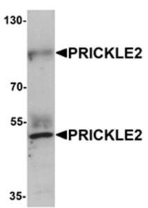 PRICKLE2 Rabbit Polyclonal Antibody