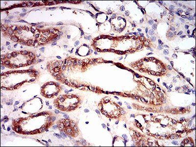 PRKAG1 Antibody