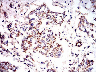 PRKAG1 Antibody