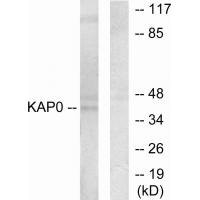 PRKAR1A Antibody