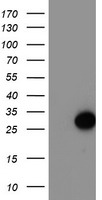 PRKAR1B Antibody