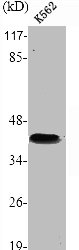 PRKAR1B Antibody
