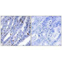 PRKAR2B Antibody