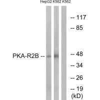 PRKAR2B Antibody