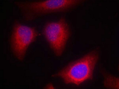 PRKCQ Antibody