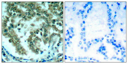 PRKCQ Antibody