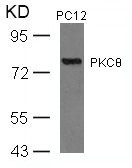 PRKCQ Antibody