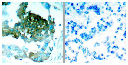 PRKCQ Antibody
