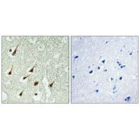 PRKCQ Antibody