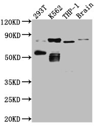 PRKCQ Antibody