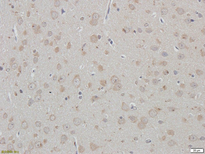 PRKG2 antibody