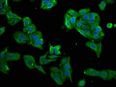 PRKRA Antibody