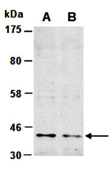 PRMT1 (N) Antibody, Rabbit Polyclonal