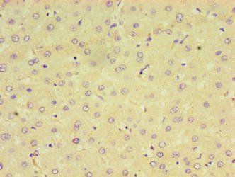 CPVL Antibody