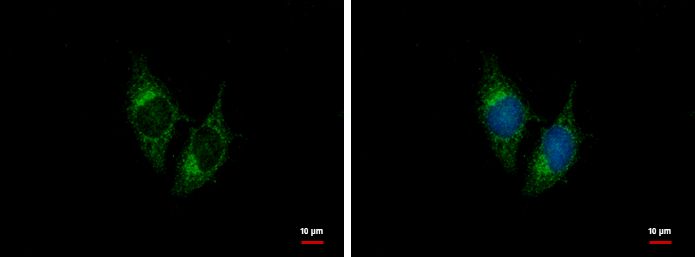 natriuretic peptide B Antibody