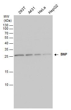 natriuretic peptide B Antibody