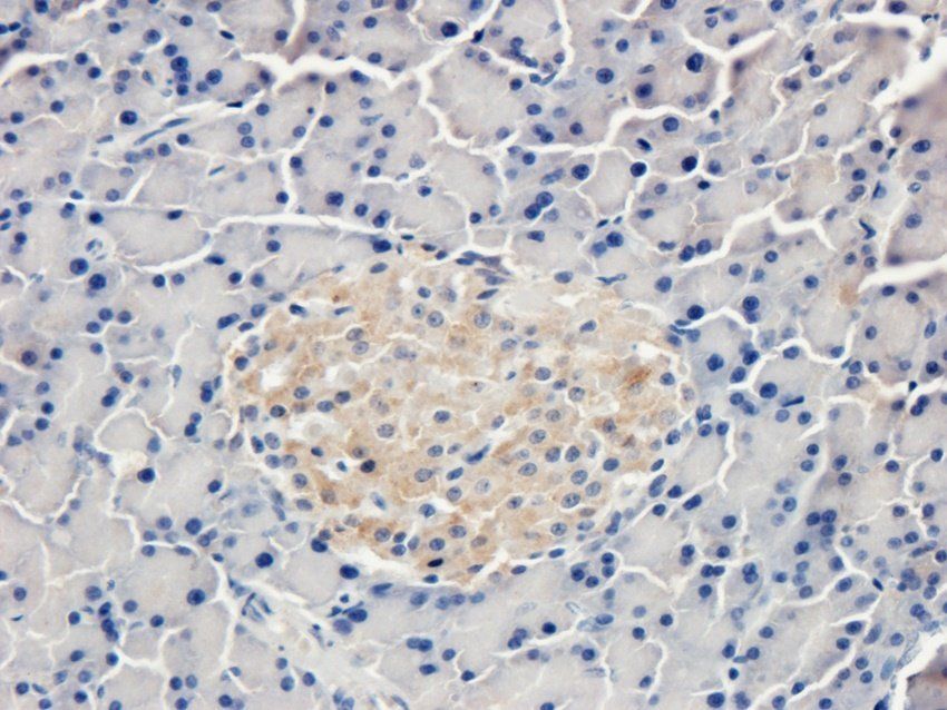 Procollagen type I Rabbit Polyclonal Antibody