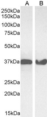 GAPDH (Internal) Antibody