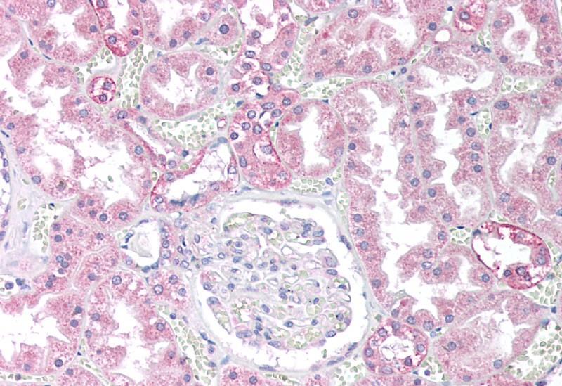 PPP2CA/PPP2CB Antibody