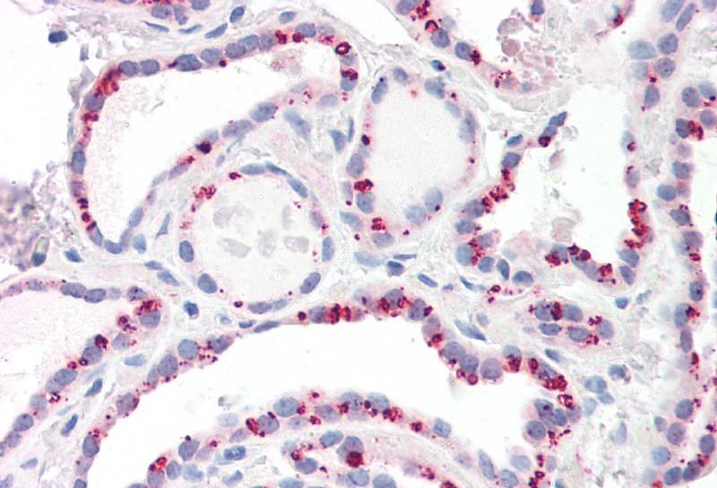 PPP2CA/PPP2CB Antibody