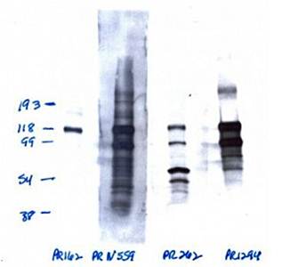 Progesterone Receptor Monoclonal Antibody (Phospho S162)