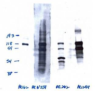 Progesterone Receptor Monoclonal Antibody (Phospho S162)