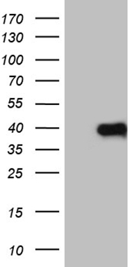 Prostate Specific Antigen (KLK3) Mouse Monoclonal Antibody [Clone ID: OTI2C9]