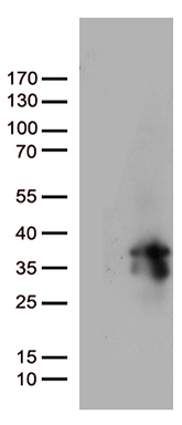 Prostate Specific Antigen (KLK3) Mouse Monoclonal Antibody [Clone ID: OTI2C9]