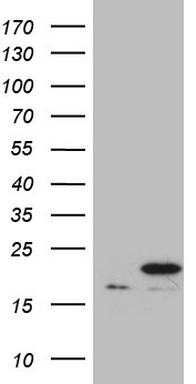 Prostate Specific Antigen (KLK3) Mouse Monoclonal Antibody