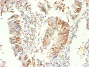 PSME3 Antibody