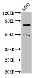 PADI2 Antibody