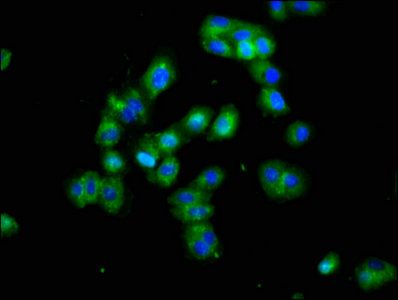 DLK1 Antibody