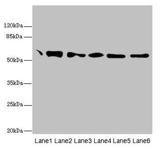 P4HB Antibody