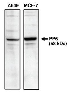 Rabbit Human Protein Phosphatase 5 (C Terminal) Antibody