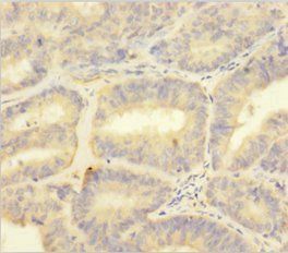 S100A1 Antibody
