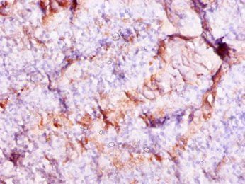 S100A9 Antibody